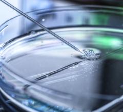 Immunolight LLC, a clinical stage biopharmaceutical firm leading the way in advancing technologies to transform cancer treatment, announced today it is now recruiting patients for a phase 1 study of its X-PACT Cancer Treatment system in Breast, Melanoma, Sarcoma and Head and Neck Cancers, to be conducted at Duke University Medical Center.