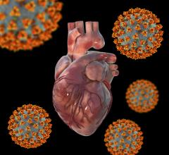 NIH supported study shows that the virus that causes COVID-19 can damage the heart without directly infecting heart tissue.