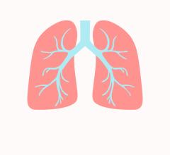 American and European experts partner to issue first guideline on definitive local therapy options for non-small cell lung cancer (NSCLC) with limited extracranial metastases 