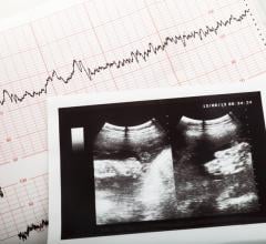 team of researchers funded by the National Institutes of Health has developed a new ultrasound technique to monitor the placenta for impaired fetal blood flow early in pregnancy. 