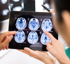 A new Harvey L. Neiman Health Policy Institute study found that patients paid 12% of the costs of secondary imaging interpretation out-of-pocket. Such secondary interpretations are increasingly performed for complex patients, but patients’ liabilities and paid out-of-pocket costs were not previously known.