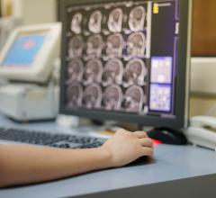 During the COVID-19 pandemic, the National Cancer Institute (NCI) is fully operating and continues to lead, conduct and support cancer research across the nation to advance scientific knowledge and help all people live longer, healthier lives, according to an editorial by Janet Eary, M.D., and Lalitha Shankar, M.D., Ph.D., published today in the journal Radiology: Imaging Cancer.