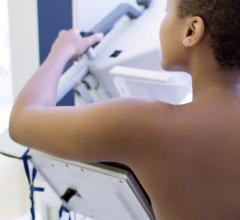 Mount Sinai Health System has launched “Mammogram May” to empower women to take charge of their breast health by scheduling an annual mammogram.