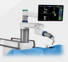 California Outpatient Surgery Center Purchases First Globus ExcelsiusGPS Robotic Navigation Platform