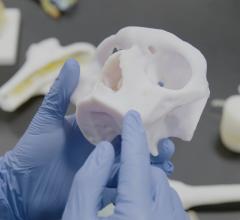 3D-printed anatomic model 
