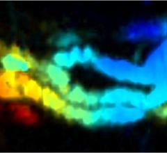 New Imaging Agent Provides Better Picture of the Gut