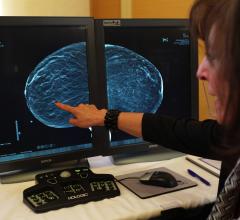 Digital Mammography Increases Breast Cancer Detection
