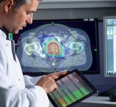 IBA Launches Monte Carlo Patient QA for Varian Halcyon at AAPM 2019