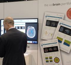 Looking for the telltale signs of brain injury in comouted tomography (CT) scans? Belgium’s icometrix is showed how its FDA-cleared icobrain can help.  The company describes at its booth in Machine Learning Showcase. #RSNA18 #RSNA2018 #RSNA