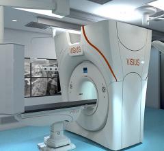 IMRIS, Siemens Strengthen Collaboration in Hybrid OR Neurosurgical Market