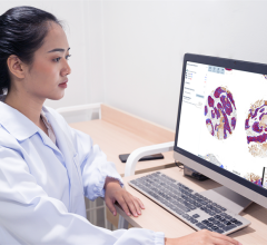 The CE-IVD marked Aiforia Clinical AI Model for Lung Cancer; PD-L1 is intended for use by pathologists in supporting them to detect and calculate the levels of the biomarker in non-small cell lung cancer cases.
