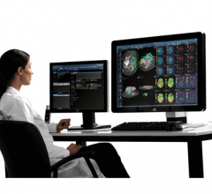 impax agility agfa PACS