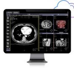 Infinitt PACS 7.0 is a faster, more powerful viewer that was built from the ground up to support AI for image analysis and for operational/ workflow improvements in radiology