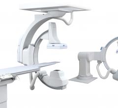 angiography systems hybrid OR tables surgical toshiba infinix dp-i