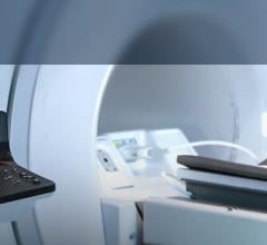 MRI-guided focused ultrasound