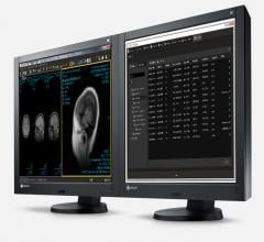 Intelerad Commits $75 Million to R&D for New AI and Cloud-based Medical Imaging Software