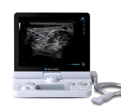 Konica Minolta Healthcare Americas, Inc. announced an agreement with Medovate Ltd. to jointly promote Medovate’s SAFIRA regional anesthesia injection solution with Konica Minolta's range of solutions for ultrasound-guided procedures in the USA. 