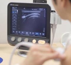 Konica Minolta Healthcare Announces UGPro Solution for Ultrasound-Guided Procedures