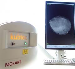 Kubtec Introduces Automatic Specimen Alert to Mozart 3-D Tomosynthesis System