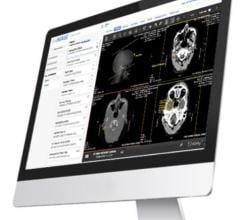 LifeImage LITE Application Expands Image Sharing Network to 1,500 Connected Hospitals