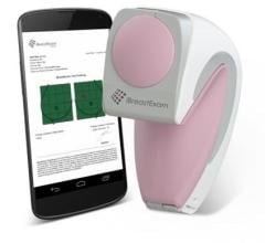 UE LifeSciences has entered into a definitive distribution agreement with Siemens Healthineers, adding its flagship device iBreastExam to Siemens’ 360-degree breast care product portfolio for the U.S. market.