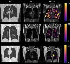 Example CT, proton, proton and RBC:TP imaging from post-Covid-19 condition participants. 