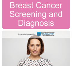 The National Comprehensive Cancer Network (NCCN) has published new NCCN Guidelines for Patients: Breast Cancer Screening and Diagnosis to help people understand their personal risk for breast cancer, when they should begin screening, and how often to screen 