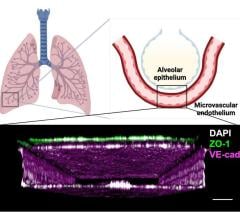 Human life-like in vitro model of radiation damage sustained to the lung opens an unprecedented window into the early disease process, and opportunities for drug development 