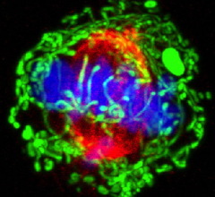 A triple-negative breast cancer cell during cell division. Tubulin in red; mitochondria in green; chromosomes in blue. Image courtesy of Wei Qian, National Cancer Institute