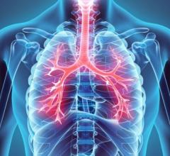 STS—in collaboration with the GO2 Foundation for Lung Cancer and the American College of Radiology—formally requested that CMS update its coverage policies to reflect the new USPSTF lung cancer screening guidelines.