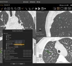 lung cancer, nonsolid nodules, NSNs, CT scan follow-up, computed tomography, Claudia Henschke