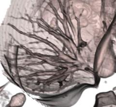 CT Lung Scan Operating Room AATS