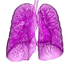 EGFR mutant lung cancer, brain metastases, order of treatment, radiation therapy, EGFR-directed drugs, Journal of Clinical Oncology study