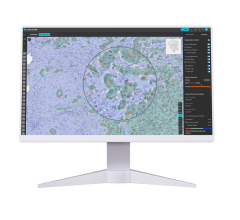 Lunit SCOPE IO transforms pathologist discordance into concordance and predicts treatment response for breast cancer, enhancing the landscape of personal oncology care 
