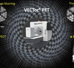 MILabs Introduces Futuristic PET Capabilities on New VECTor6 System