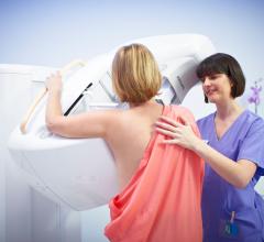 MicroDose SI FDA Clearance Full-Field Digital Mammography