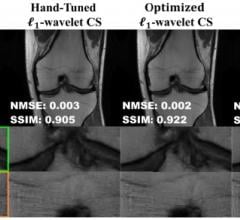 University of Minnesota Twin Cities researchers have found a way to improve the performance of traditional Magnetic Resonance Imaging (MRI) reconstruction techniques, allowing for faster MRIs without relying on the use of newer deep learning methods. Credit: Intelligent Medical Imaging and Image Processing Lab, University of Minnesota 
