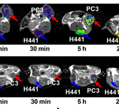 Novel MRI Imaging Agent More Effectively Monitors Impact of Treatment in Lung, Prostate Cancers
