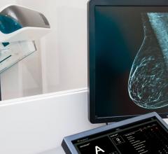 Densitas Inc., a global provider of A.I. technologies for digital mammography and breast screening, announced its partnership with Mammography Educators to offer the first artificial intelligence powered telehealth technologist training platform to support business continuity in mammography facilities.