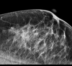 mammography, comparison, prior examinations, UCSF study, American Journal of Roentgenology