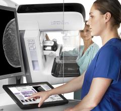 American Cancer Society, ACS, breast cancer screening guidelines, annual mammography, age 45