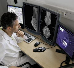 FDA Releases Six-Month Inspection Data From EQUIP Mammography Quality Initiative