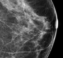 Lake Havasu Imaging Center, mammography quality problem, ACR accreditation, MQSA