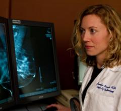 Gender, Race Shape How Barriers to Breast Cancer Screening Are Addressed