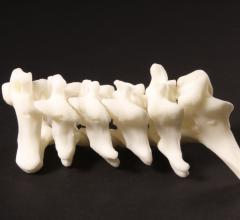 Materialise First Company to Receive FDA Clearance for Diagnostic 3-D-Printed Anatomical Models