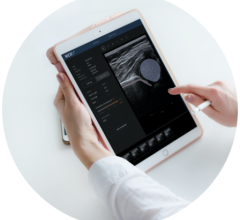 Medo, a technology startup and world leader in using artificial intelligence (AI) to drastically simplify ultrasound in healthcare,  and Medical Imaging Consultants (MIC), Western Canada’s leading radiology partnership, are thrilled to announce their partnership aimed at revolutionizing diagnostic imaging.