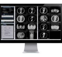 Blackford, the centralized medical imaging platform, today announced that it had signed a multi-year agreement with IBM to integrate the Blackford Registration into IBM’s AI-ready workflow platform, Merge PACS