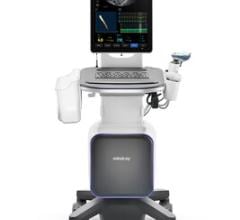 Mindray's strategic entrance into the transient elastography market illustrates its dedication to advancing medical technologies to make healthcare more accessible 