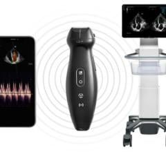 Mindray charges ahead and disrupts the point of care market again with its first wireless handheld ultrasound imaging solution 