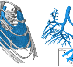 A 3D image of a mouse's lungs, created with the new technique developed at KTH. Image courtesy of KTH Royal Institute of Technology